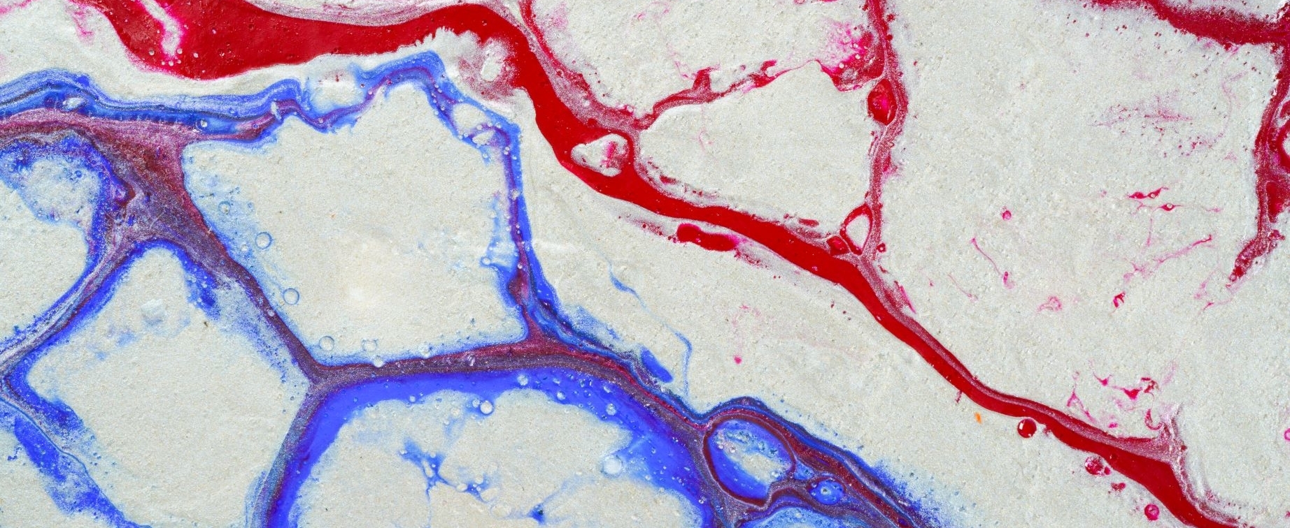 How does Eliquis Function as a Blood Thinner in the Body?