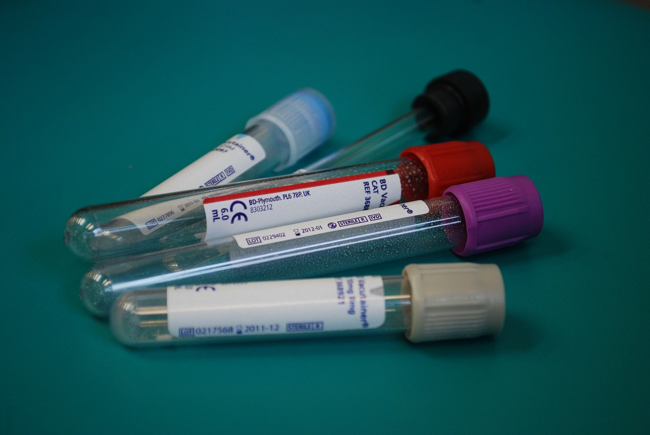 A collection of storage tubes for drawn blood with different coloured caps (blue, black, red, purple, gray) on a teal background.